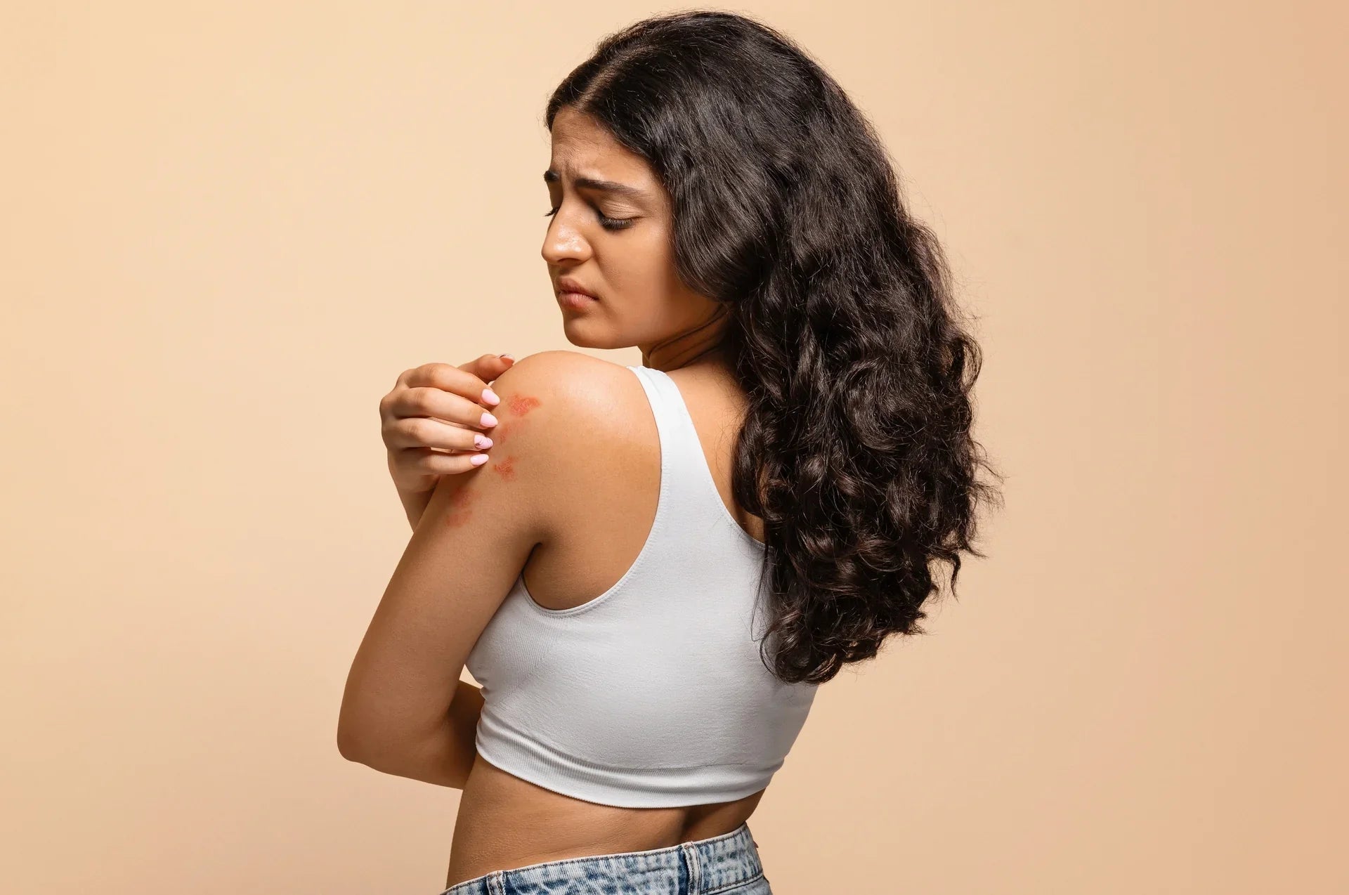 Psoriasis – So durchbrichst du den Schub-Kreislauf 💪✨