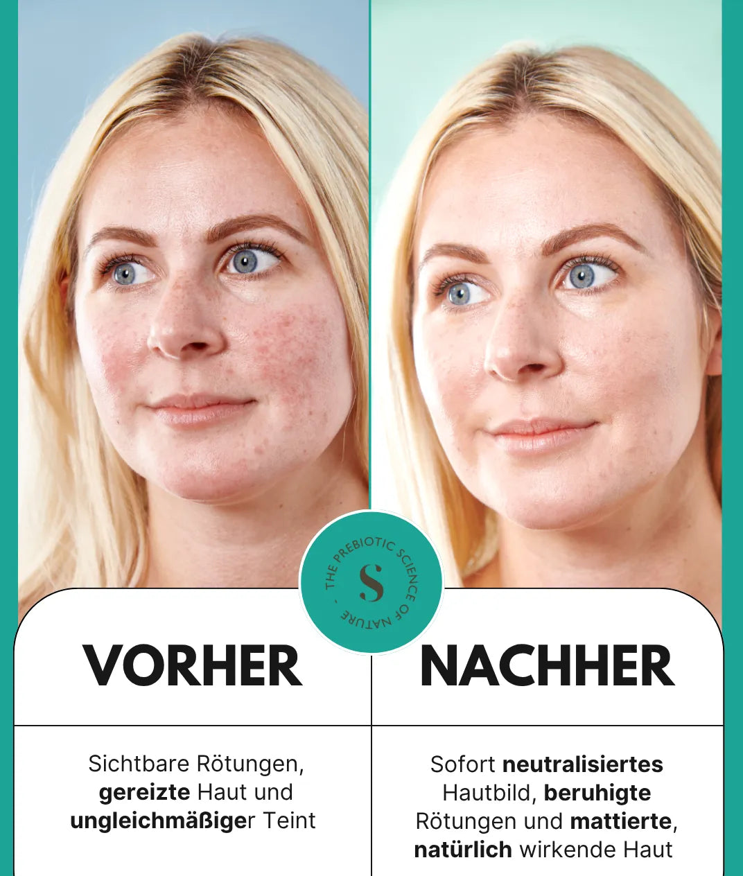 5 in 1 Anti-Rötungen Tagescreme