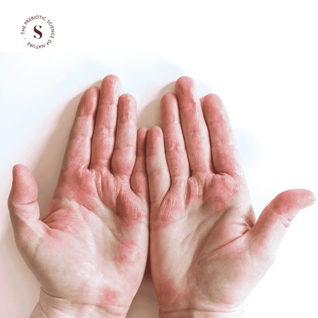 WINTERHAUT-ESSENTIALS - ALLES, WAS SIE WISSEN MÜSSEN, UM IHRE WINTER-HAUTPFLEGEROUTINE ZU PERFEKTIONIEREN