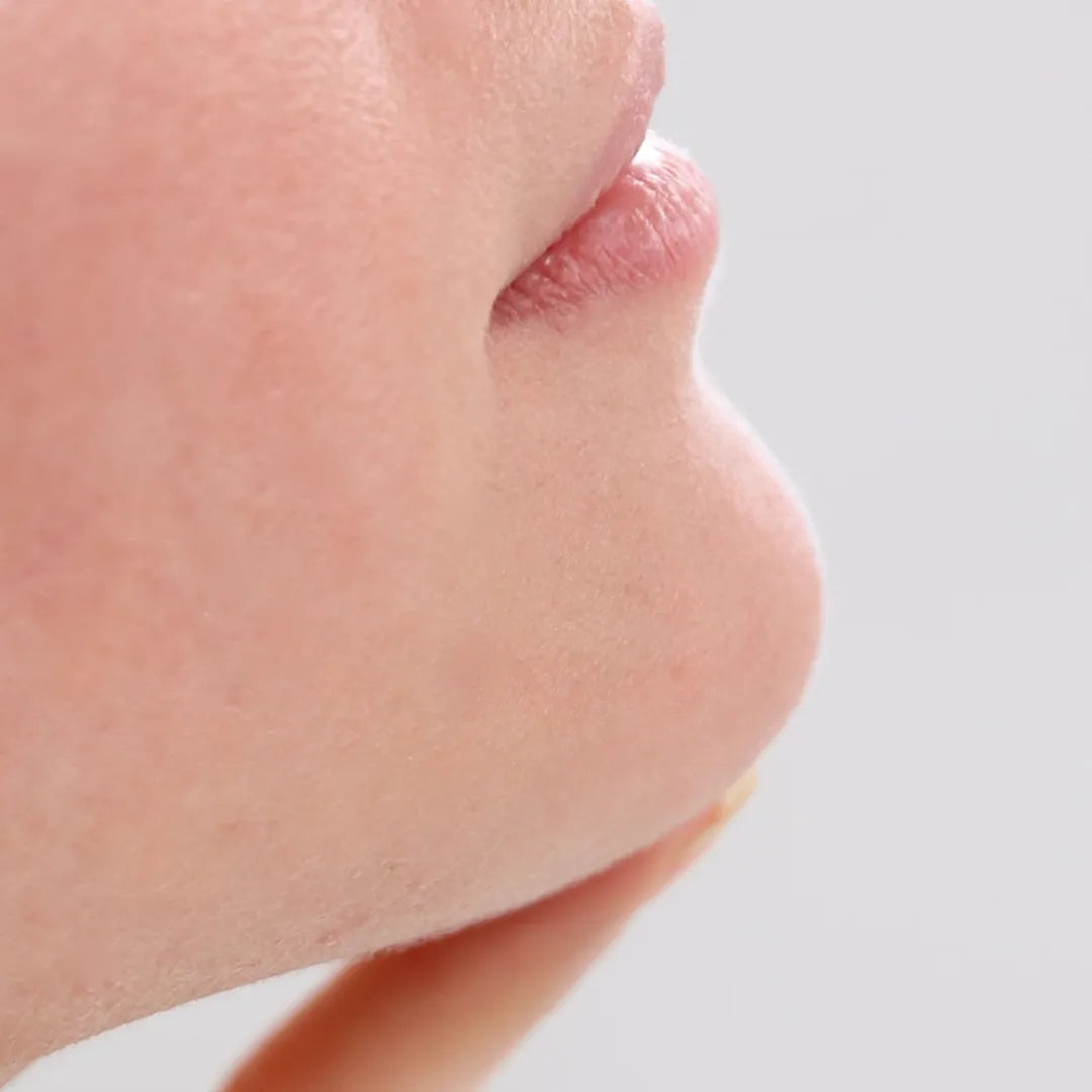 RÖTUNGEN – SYMPTOME, AUSLÖSER & BEHANDLUNGEN