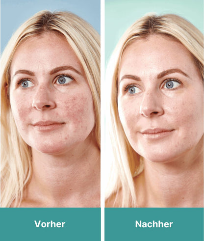 5 in 1 Anti-Redness Tagescreme SPF 50 Tagescreme Sorted Skin