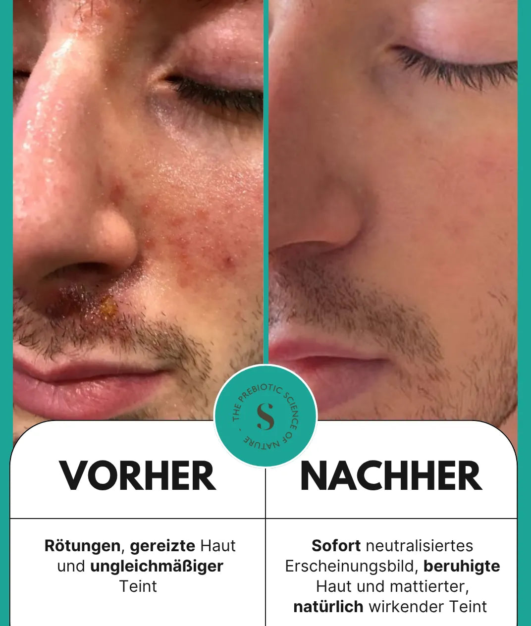 5 in 1 Anti-Redness Tagescreme