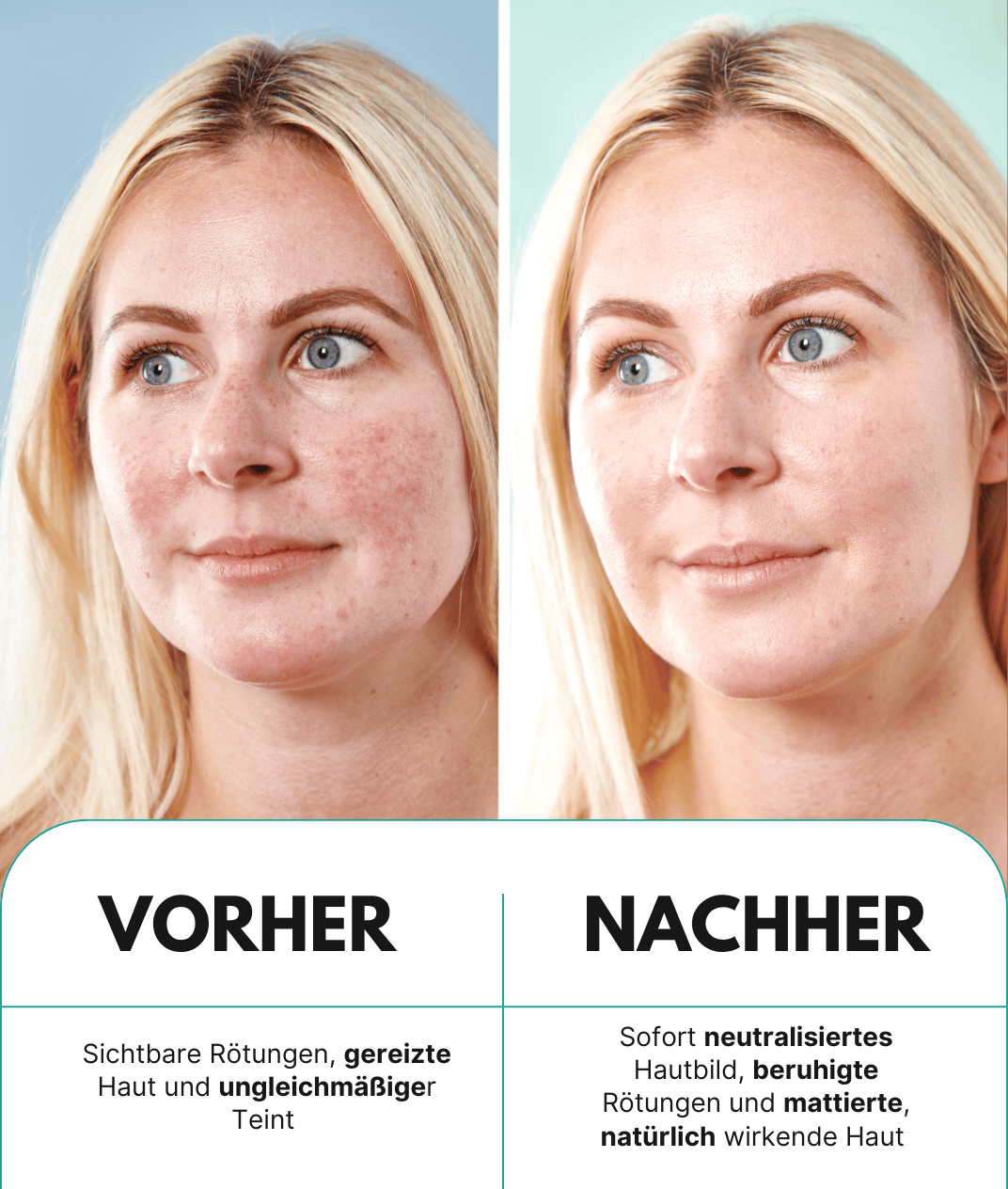 5 in 1 Anti-Rötungen Tagescreme