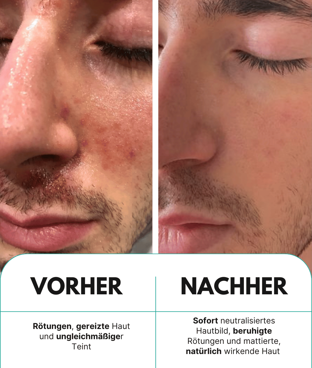 5 in 1 Anti-Rötungen Tagescreme